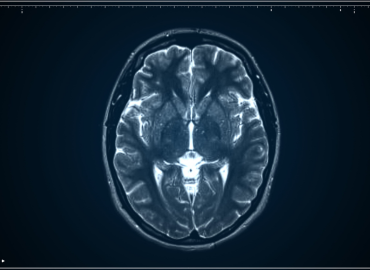 scanner rambot examens